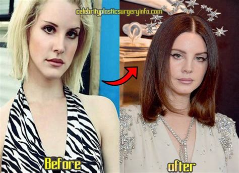 Here is the transformation of Lana. She gave us so many  .